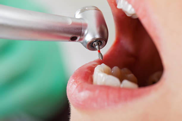 Best Emergency Denture Repair in Dell Rapids, SD